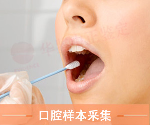 大同口腔拭子采集方法