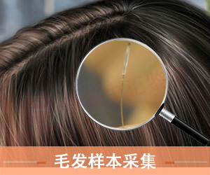 大同毛发样本采集方法