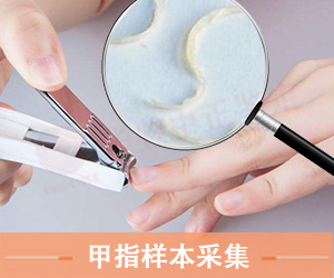 大同指甲样本采集方法